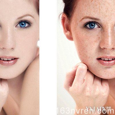 【论美子】脸上色斑形成的原因有哪些？ 从3大食疗助你远离色斑